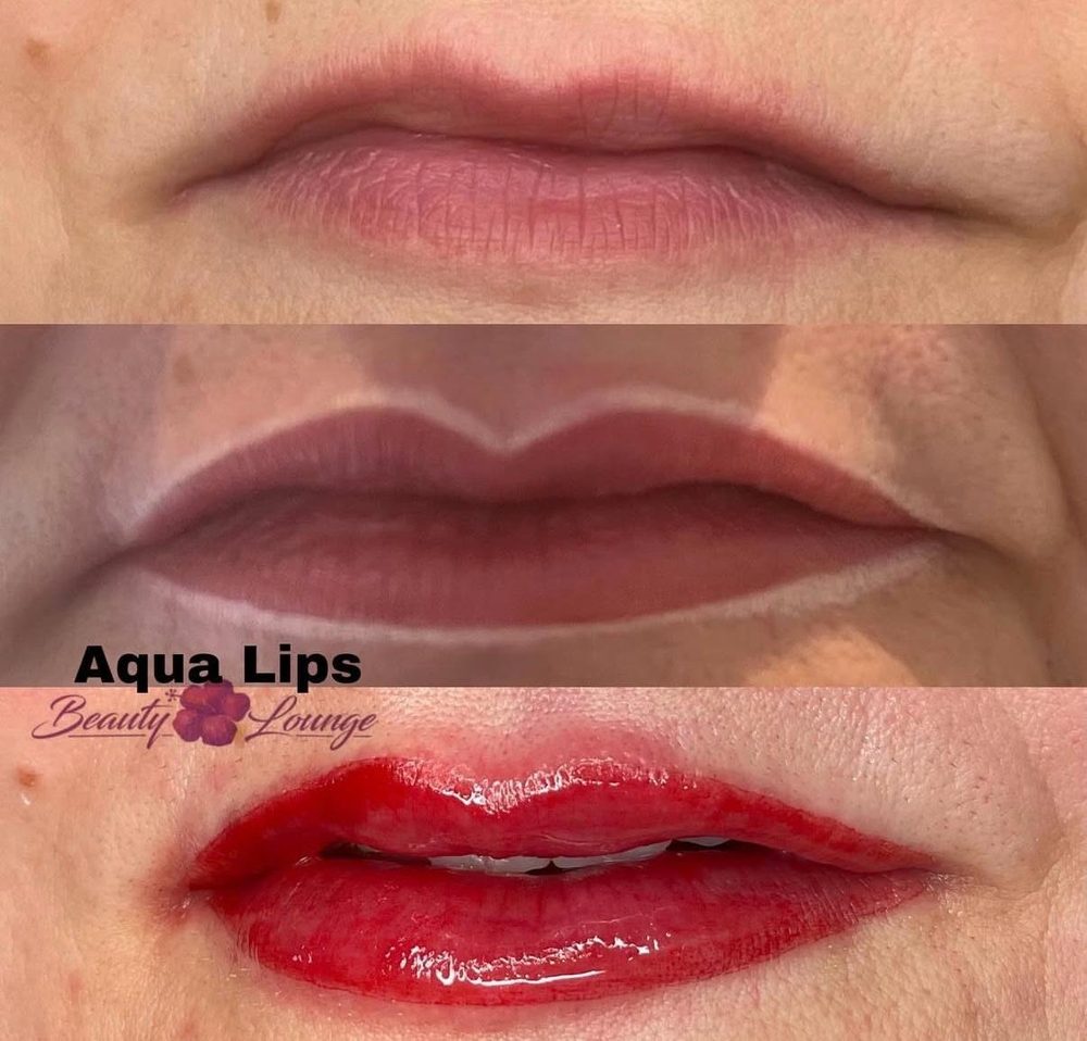 Aqua Lips im Vorher-Nachher-Vergleich
