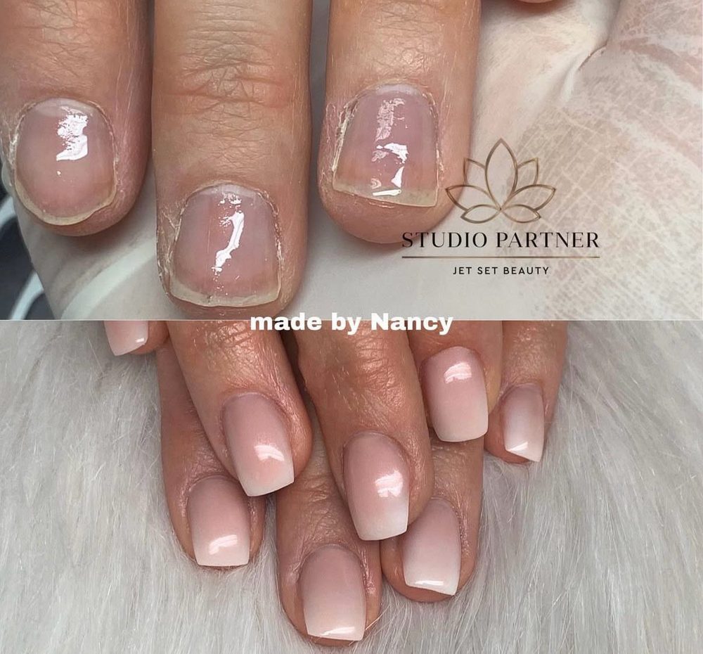 Natürliche Nagelmodellage im Vorher-Nachher-Vergleich